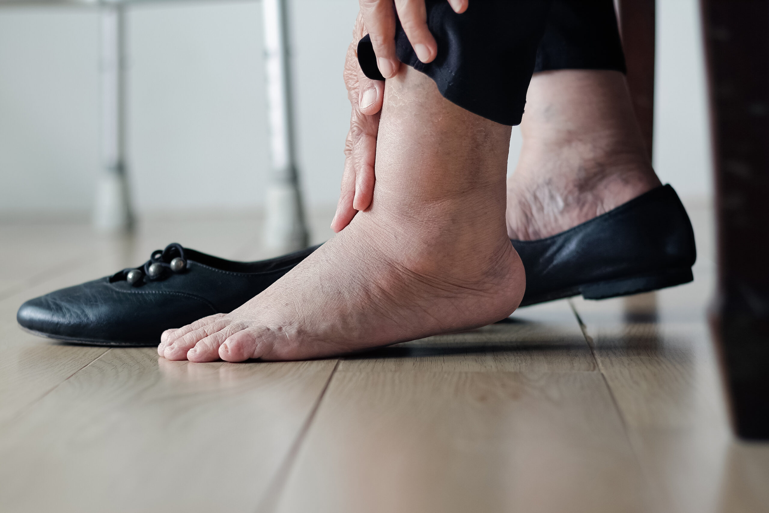 The Surprising Benefits Of Wearing Stretchy shoes for swollen feet